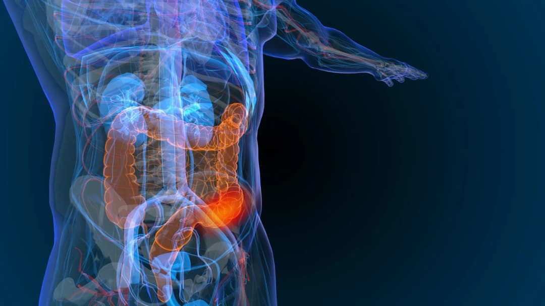 Gold Coast Endoscopy specialist care